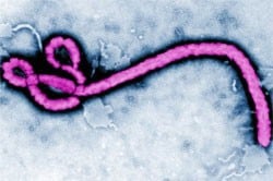 Ebola Disease