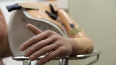 Arm prosthesis
