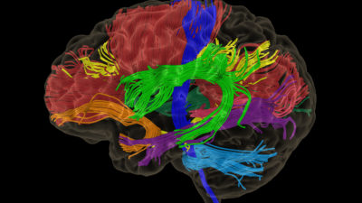 Screen shot of software, brightly colored brain