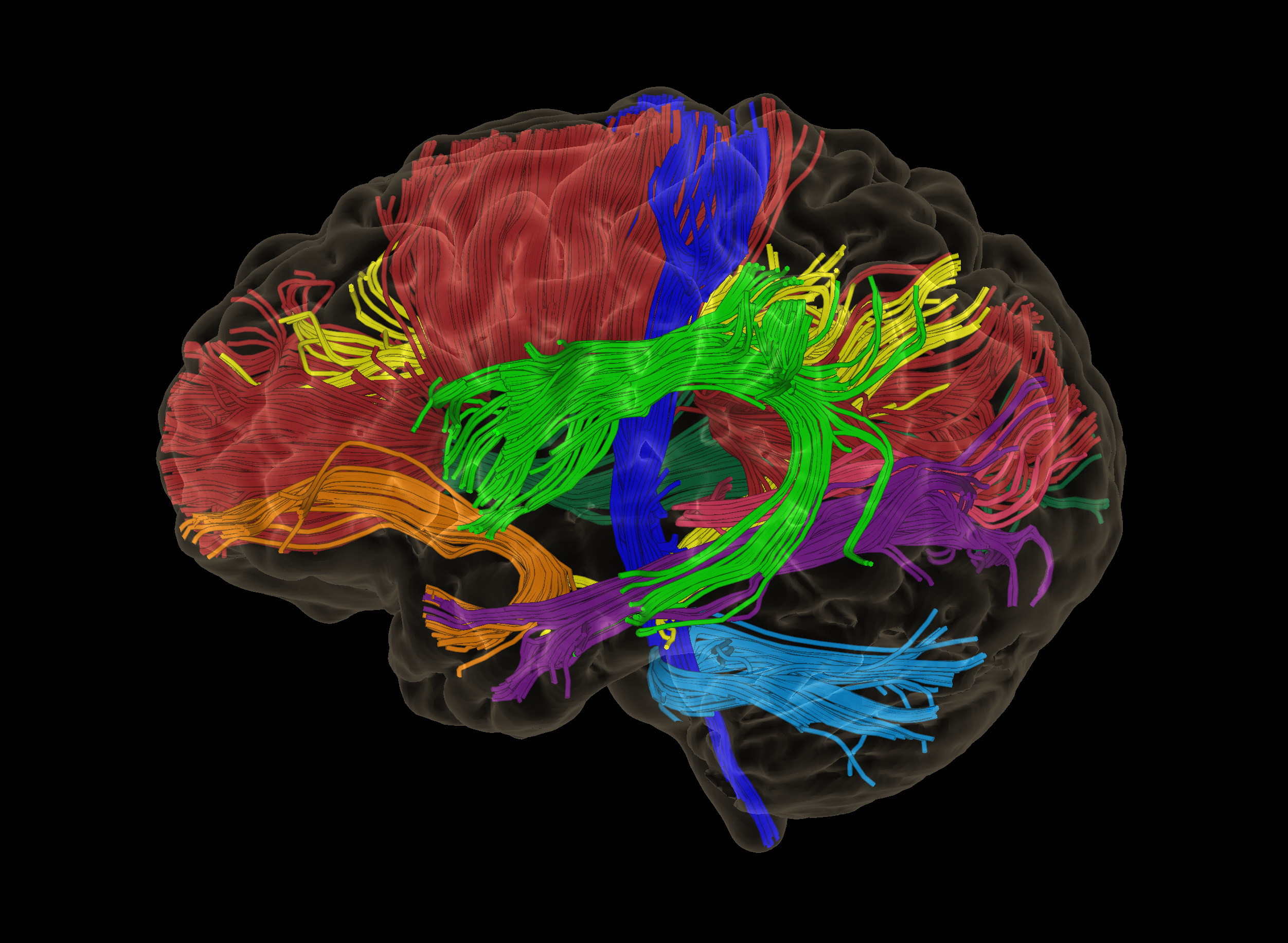 Screen shot of software, brightly colored brain