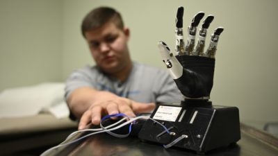 Bryce Cook reaches toward a therapy tool used to help patients learn to use muscle sensors to control a robotic prosthetic.