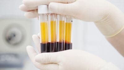 Gloved hands holding plasma viles