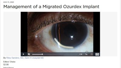 A clip from a video by Riley Sanders, M.D., and Sami Uwaydat, M.D., featured on the American Academy of Ophthalmology website, where it's accessible to an international audience for training.