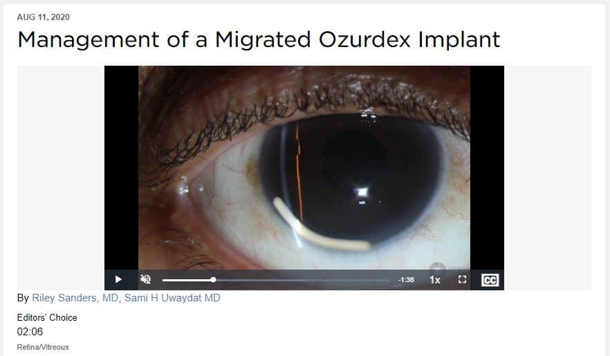 A clip from a video by Riley Sanders, M.D., and Sami Uwaydat, M.D., featured on the American Academy of Ophthalmology website, where it's accessible to an international audience for training.