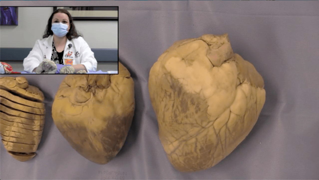 picture of Erica Malone, Ph.D., sitting in front of three animal hearts
