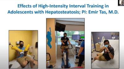 The Showcase of Medical Discoveries included a range of obesity-related research, including a study about high intensity interval training (HIIT) in children.