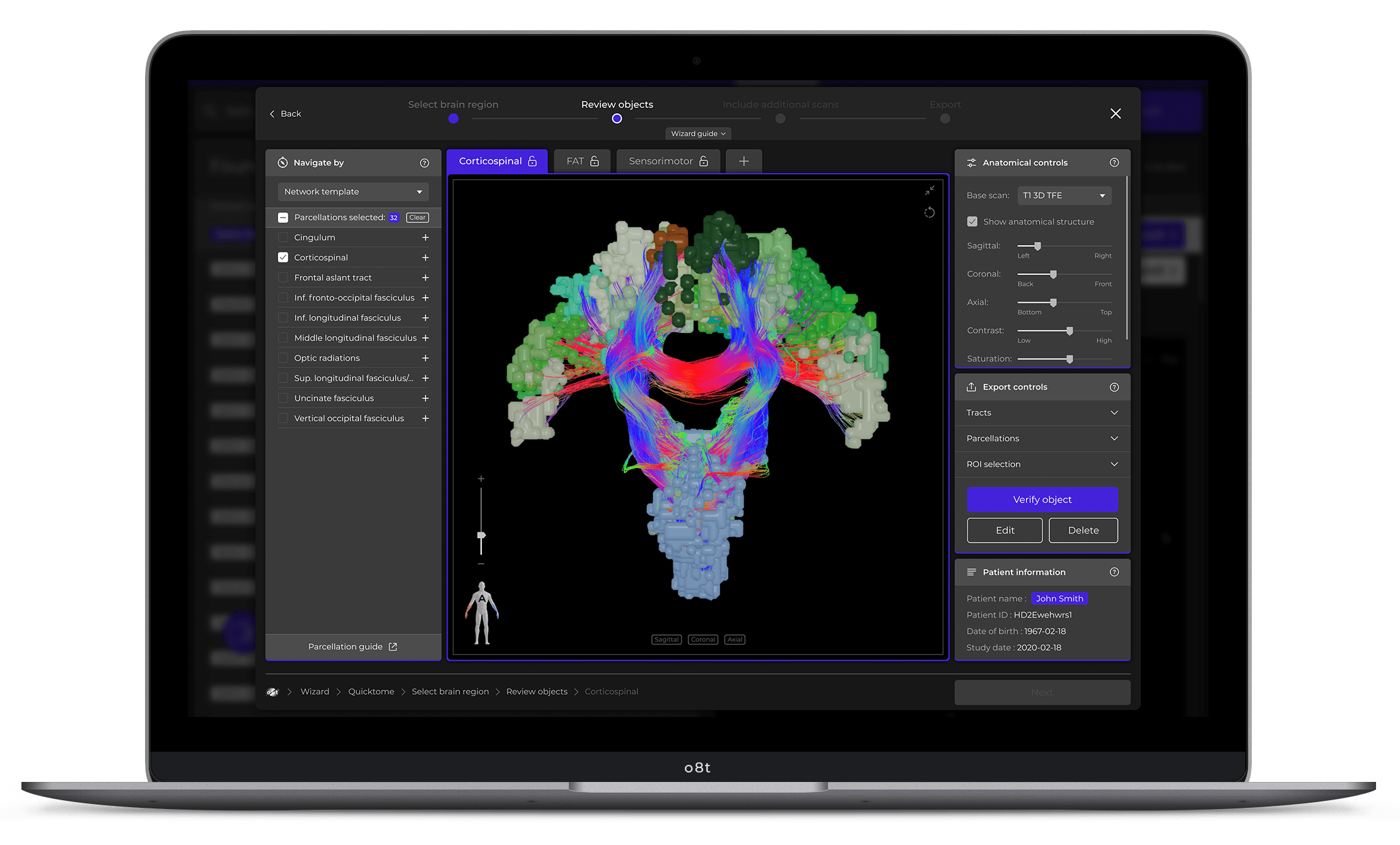 An example of how the brain-imaging technology looks on a computer screen.