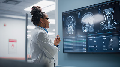 Doctor Looking at Brain Scans