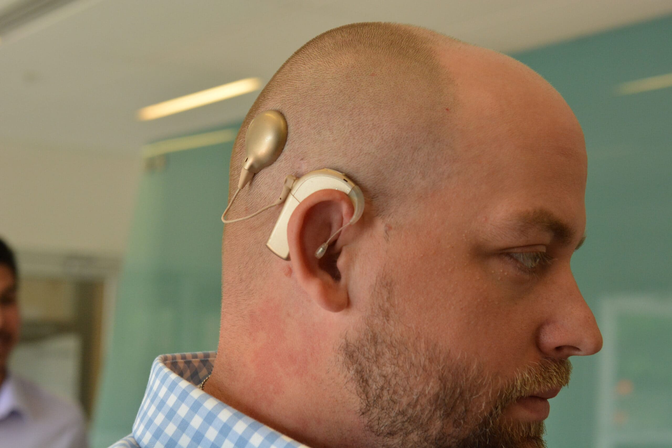 Audiology patient displays cochlear implant device