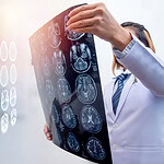 Medical professional examining brain scan images in a hospital setting.