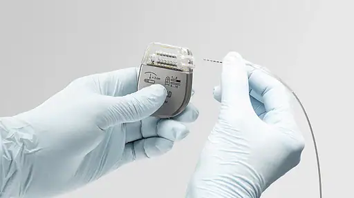 Image shows Onward Medical’s implantable ARCIM System, which is designed to address symptomatic blood pressure instability in individuals with chronic spinal cord injury. Device is small and silver with tubing and is held in gloved hands.