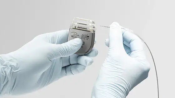 Image shows Onward Medical’s implantable ARCIM System, which is designed to address symptomatic blood pressure instability in individuals with chronic spinal cord injury. Device is small and silver with tubing and is held in gloved hands.