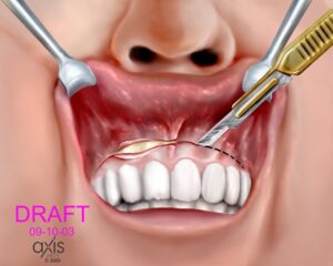 An image of one of Tribell's pictures showing a mouth and dental or surgical tools.